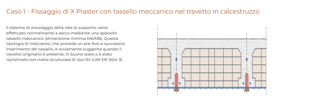 Fissaggio di X-Plaster Ruregold