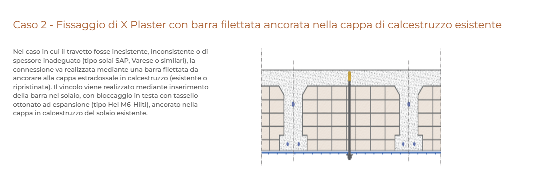 Fissaggio di X-Plaster Ruregold