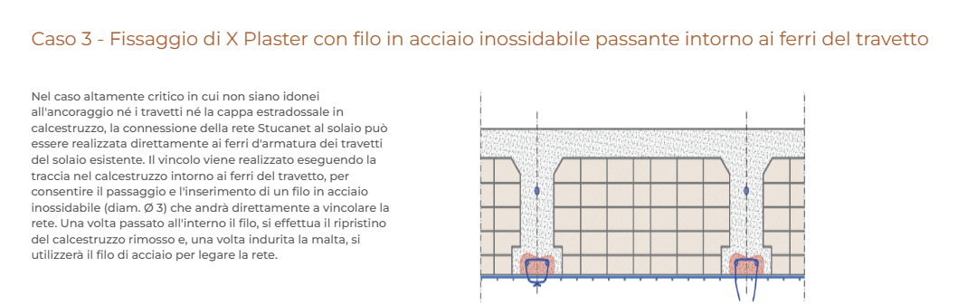 Fissaggio di X-Plaster Ruregold